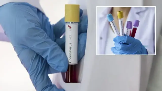 zayiflar kovid 19u daha agir geciriyor PRb3JOAy.webp